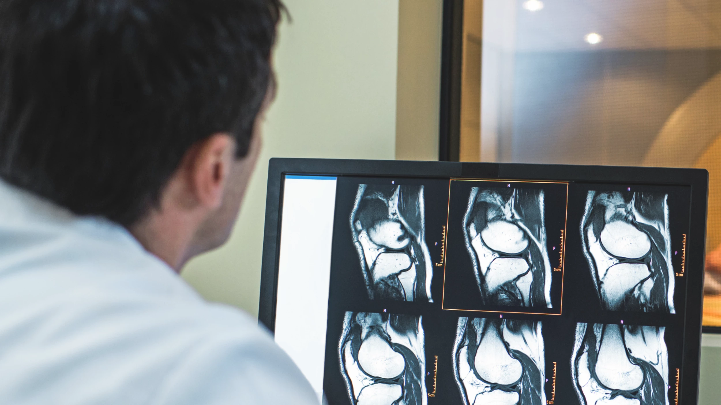 radiologist closeup of screen